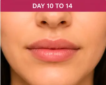 Day 10 to 14