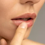 Can You Kiss After a Lip Flip