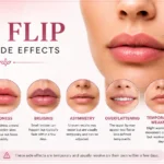Lip Flip Botox Side Effects