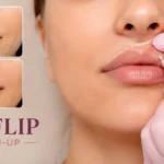 Lip Flip Touch-Up